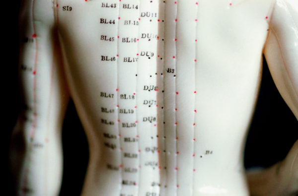 Best Acupuncturist in Cairo