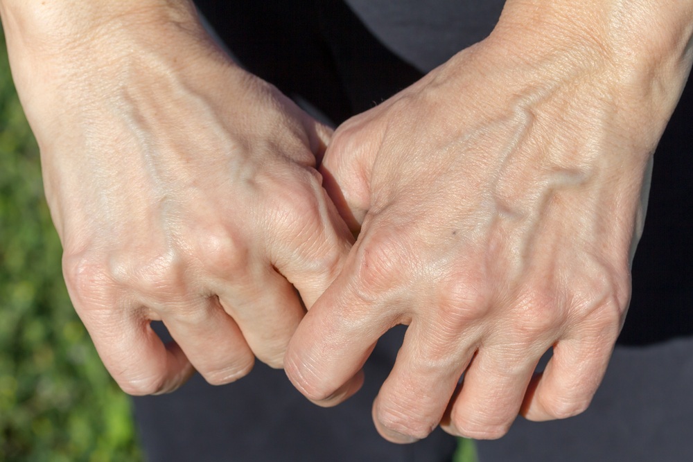 Best Physiotherapy clinic in Egypt for Wrist and Hand treatment