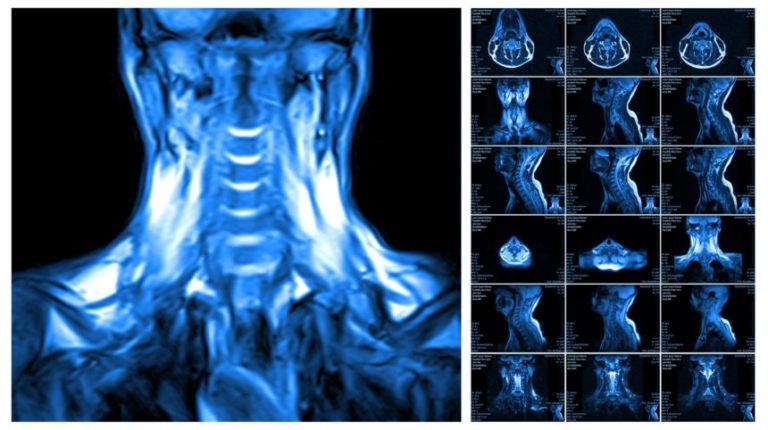 trapezius_sh_449132269-1-860×482