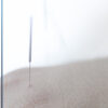 Best Dry Needling Therapy treatment in Egypt - Sheikh zayed - Nasr city - New cairo